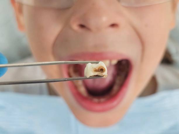 Best Emergency Treatment for Toothache in Lehighton, PA